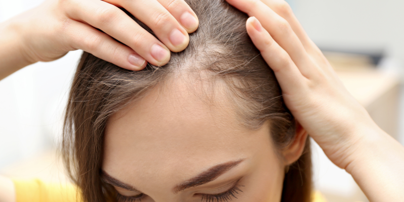 Hair Fibers 101: Do They Really Hold Up? Here’s What You Need to Know If You Have Thinning Hair